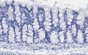 Anti-iNOS (NOSII) Antibody, clone 2G17 ZooMAb Rabbit Monoclonal 