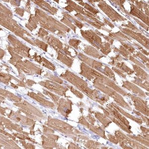 Anti-INPP4B antibody produced in rabbit 
