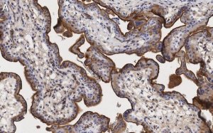 Anti-Integrin -5 Antibody, clone 5E18 ZooMAb Rabbit Monoclonal 