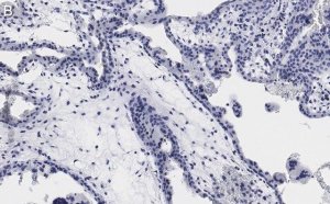 Anti-Integrin -5 Antibody, clone 5E18 ZooMAb Rabbit Monoclonal 