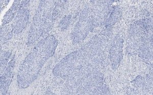 Anti-Integrin 1 Antibody, clone 1A27 , ZooMAb Rabbit Monoclonal 