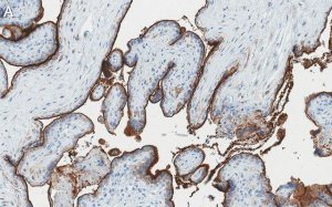 Anti-Integrin 3 Antibody, clone EM00212 ZooMAb Rabbit Monoclonal 