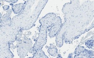 Anti-Integrin 3 Antibody, clone EM00212 ZooMAb Rabbit Monoclonal 