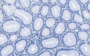 Anti-Integrin 6/CD49f Antibody, clone 5I3 ZooMAb Rabbit Monoclonal 