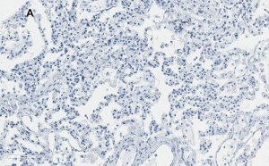 Anti-Integrin alpha V beta 6 Antibody, clone EM05201, ZooMAb Rabbit Monoclonal 