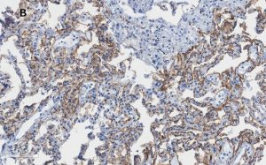 Anti-Integrin alpha V beta 6 Antibody, clone EM05201, ZooMAb Rabbit Monoclonal 
