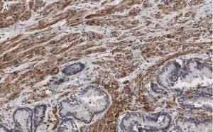 Anti-Integrin beta 1 Antibody, clone HUTS-4 ZooMAb Mouse Monoclonal 