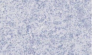 Anti-Integrin pan-V Antibody, clone EM01309 , ZooMAb Rabbit Monoclonal 