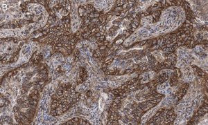 Anti-Integrin pan-V Antibody, clone EM01309 , ZooMAb Rabbit Monoclonal 