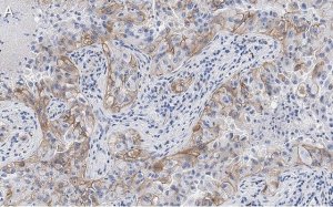 Anti-Integrin V3 Antibody, clone EM22703 ZooMAb Rabbit Monoclonal 