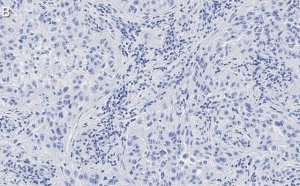Anti-Integrin V3 Antibody, clone EM22703 ZooMAb Rabbit Monoclonal 