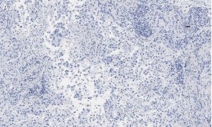 Anti-Integrin V5 Antibody, clone EM09902 , ZooMAb Rabbit Monoclonal 
