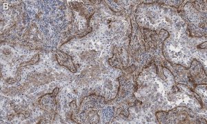 Anti-Integrin V5 Antibody, clone EM09902 , ZooMAb Rabbit Monoclonal 