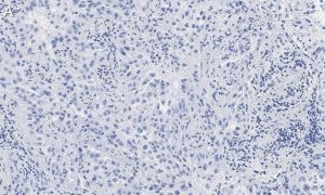 Anti-Integrin V8 Antibody, clone EM13309 , ZooMAb Rabbit Monoclonal 