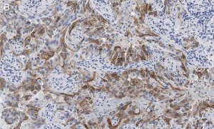 Anti-Integrin V8 Antibody, clone EM13309 , ZooMAb Rabbit Monoclonal 