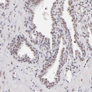 Anti-INTS6 antibody produced in rabbit 