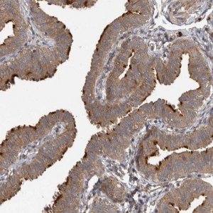 Anti-IQCK antibody produced in rabbit HPA026792-100UL