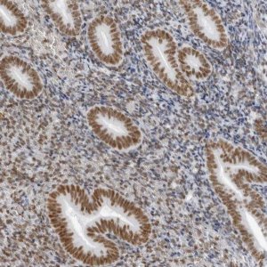 Anti-IRF2BP2 antibody produced in rabbit 