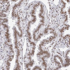Anti-IRF2BP2 antibody produced in rabbit 