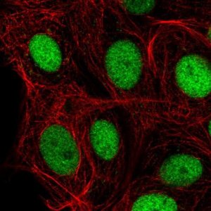 Anti-IRF2BPL antibody produced in rabbit 