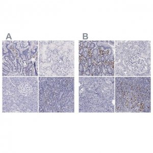 Anti-IRF4 antibody produced in rabbit 