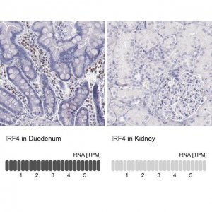 Anti-IRF4 antibody produced in rabbit 