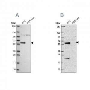 Anti-IRF6 antibody produced in rabbit 