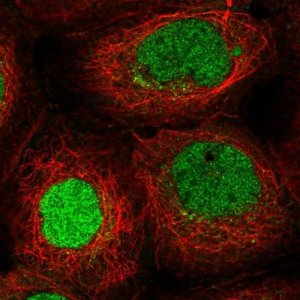 Anti-ITCH antibody produced in rabbit 