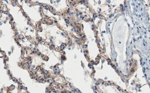 Anti-ITGA3 Antibody, clone 1D6 ZooMAb Rabbit Monoclonal 