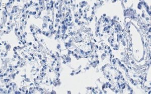 Anti-ITGA3 Antibody, clone 1D6 ZooMAb Rabbit Monoclonal 