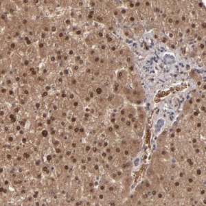 Anti-ITIH4 antibody produced in rabbit 