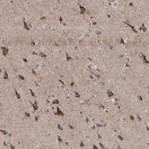 Anti-ITM2B antibody produced in rabbit 