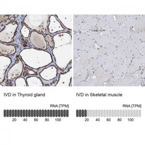 Anti-IVD antibody produced in rabbit HPA041391-100UL