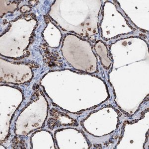 Anti-IVD antibody produced in rabbit HPA041391-100UL