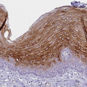 Anti-IVL antibody produced in rabbit 