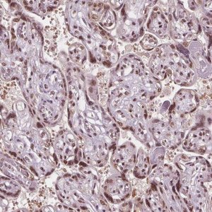 Anti-IWS1 antibody produced in rabbit 