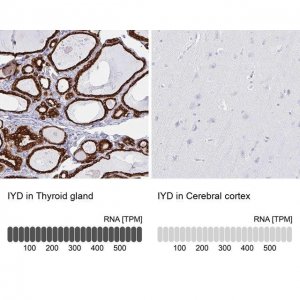 Anti-IYD antibody produced in rabbit 