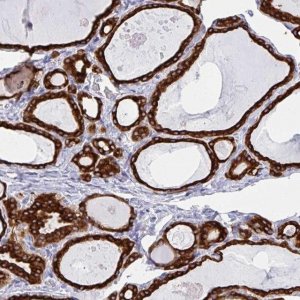 Anti-IYD antibody produced in rabbit 