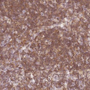 Anti-JAKMIP1 antibody produced in rabbit 