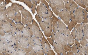 Anti-JPH2 Antibody, clone 1O14 ZooMAb Rabbit Monoclonal 