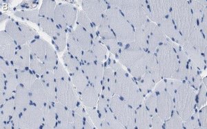 Anti-JPH2 Antibody, clone 1O14 ZooMAb Rabbit Monoclonal 
