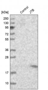 Anti-JTB antibody produced in rabbit 