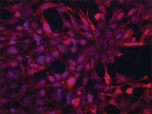 Anti-JUB (N-terminal) antibody produced in rabbit 