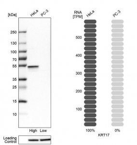 Anti-JUP antibody produced in rabbit 