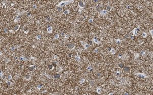 Anti-K+/Cl- Cotransporter-2 Antibody, clone 5E13 ZooMAb Rabbit Monoclonal 