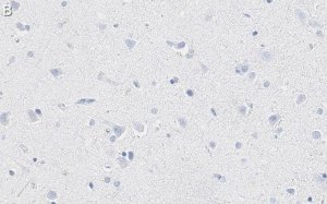 Anti-K+/Cl- Cotransporter-2 Antibody, clone 5E13 ZooMAb Rabbit Monoclonal 