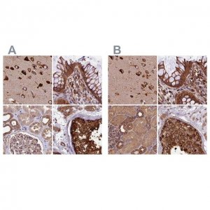 Anti-KARS antibody produced in rabbit 