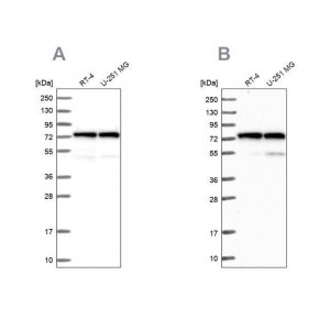 Anti-KARS antibody produced in rabbit 