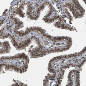 Anti-KAT5 antibody produced in rabbit 