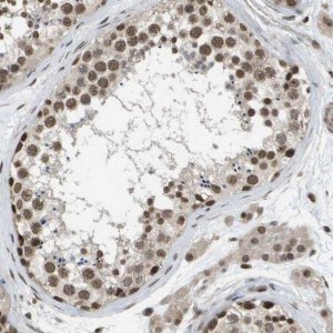 Anti-KAT5 antibody produced in rabbit 